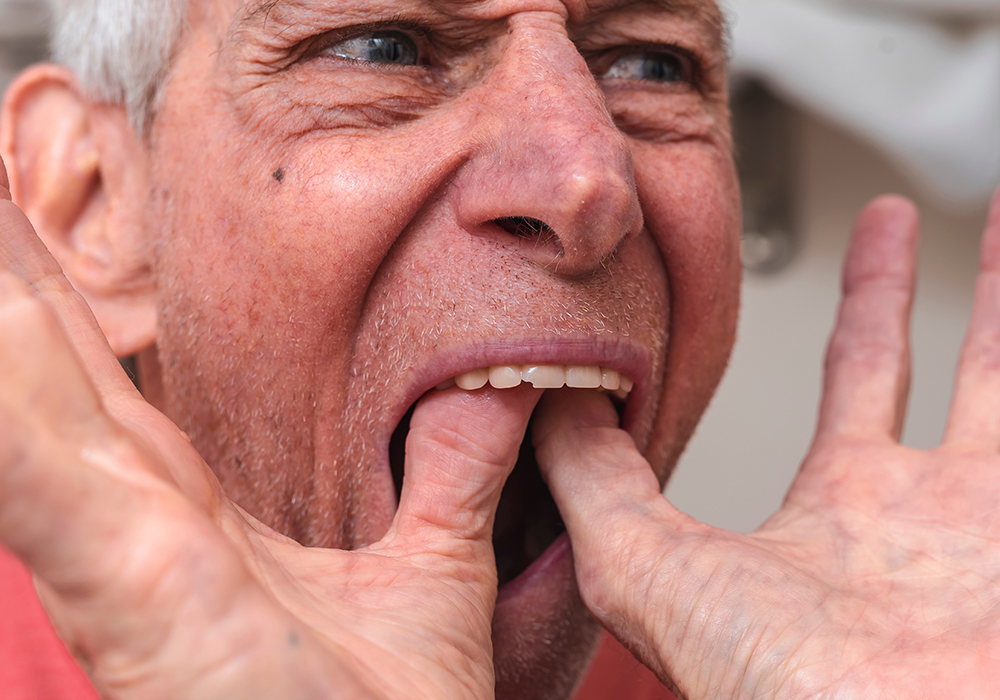 Man fitting top row of dentures in his mouth